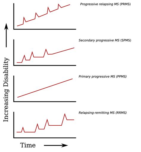 types of multiple sclerosis chart.